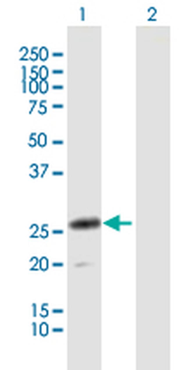 CLEC4D Antibody in Western Blot (WB)