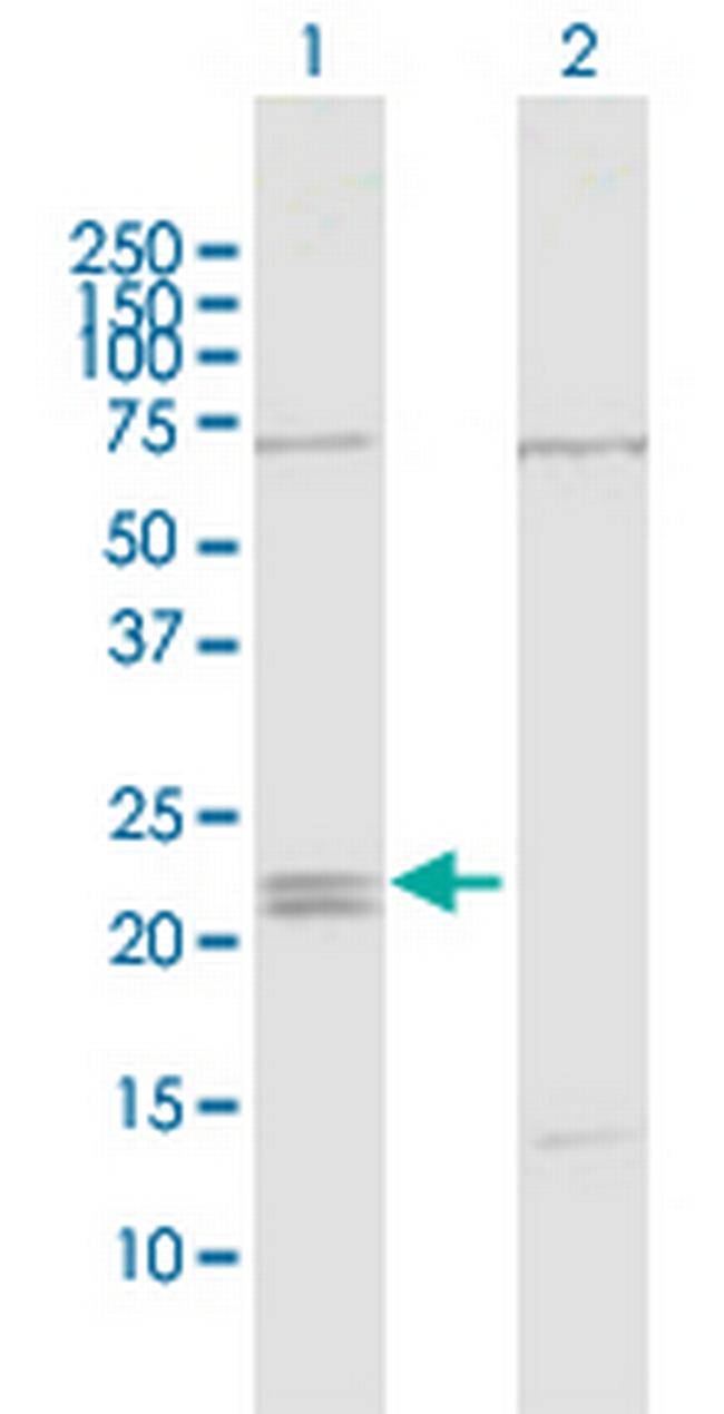 IFNE Antibody in Western Blot (WB)