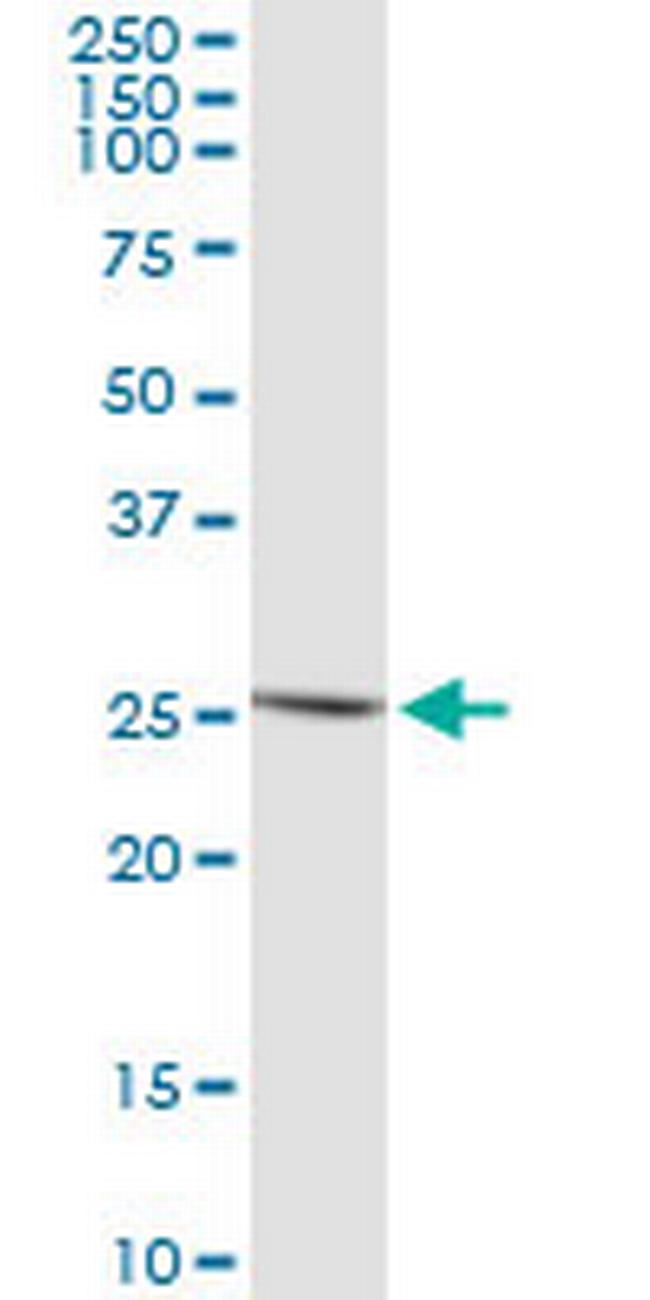 IFNE1 Antibody in Western Blot (WB)