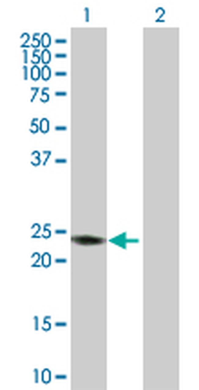 RAB7B Antibody in Western Blot (WB)