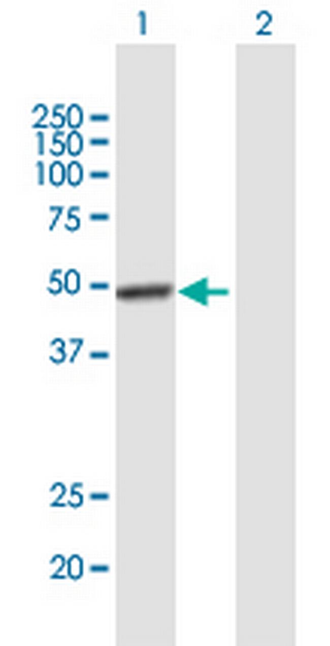 VSX2 Antibody in Western Blot (WB)