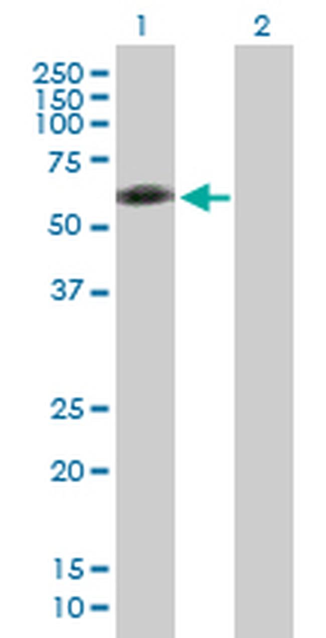 ENPP7 Antibody in Western Blot (WB)