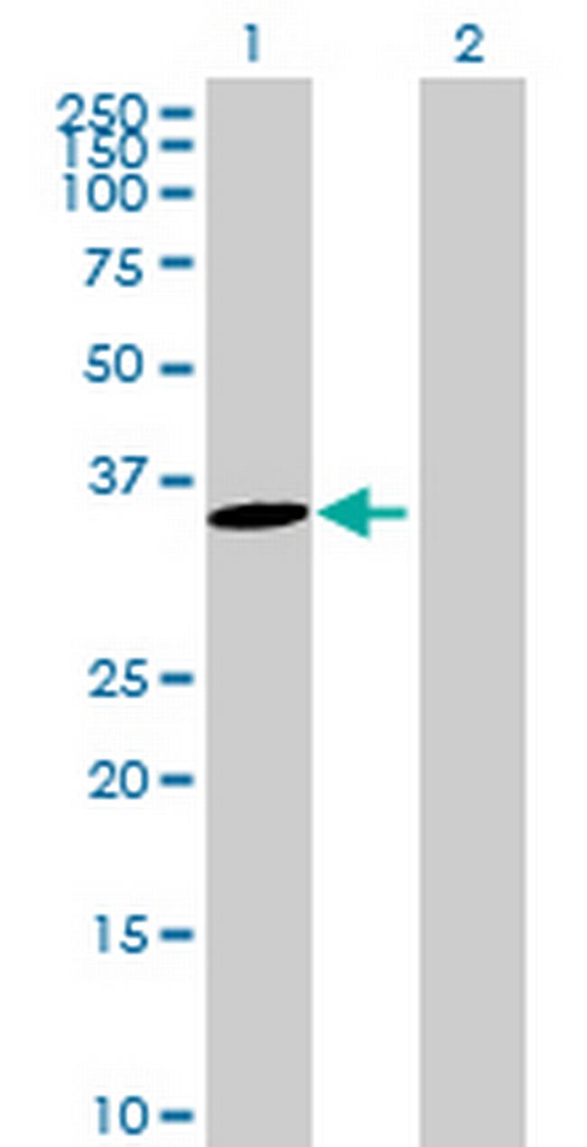 ANKRD45 Antibody in Western Blot (WB)