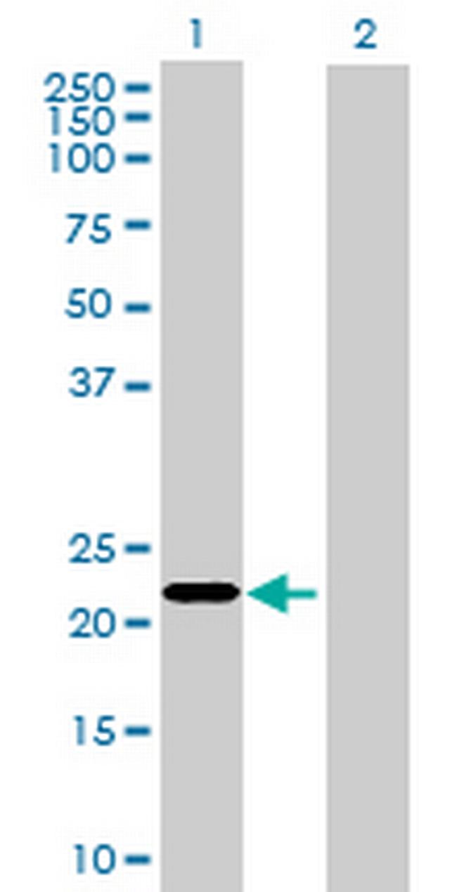KLHL17 Antibody in Western Blot (WB)