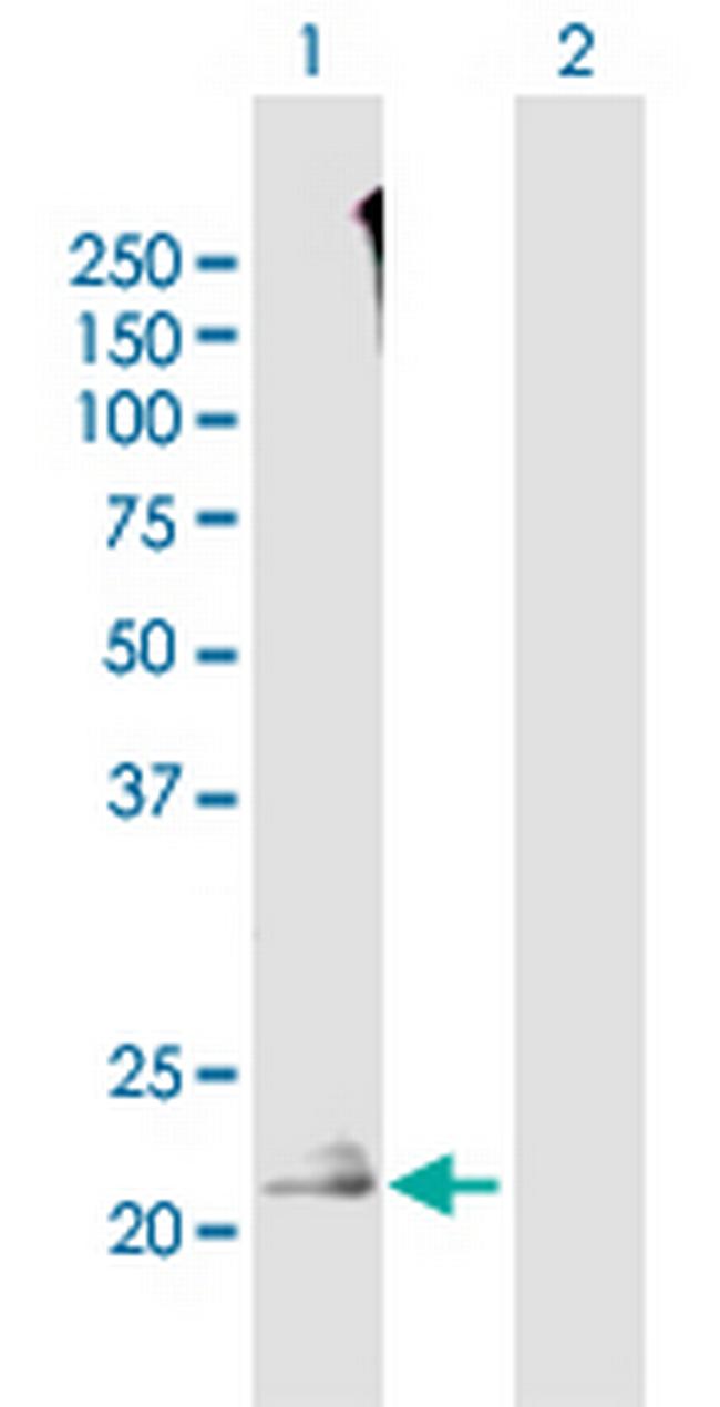 TMEM52 Antibody in Western Blot (WB)