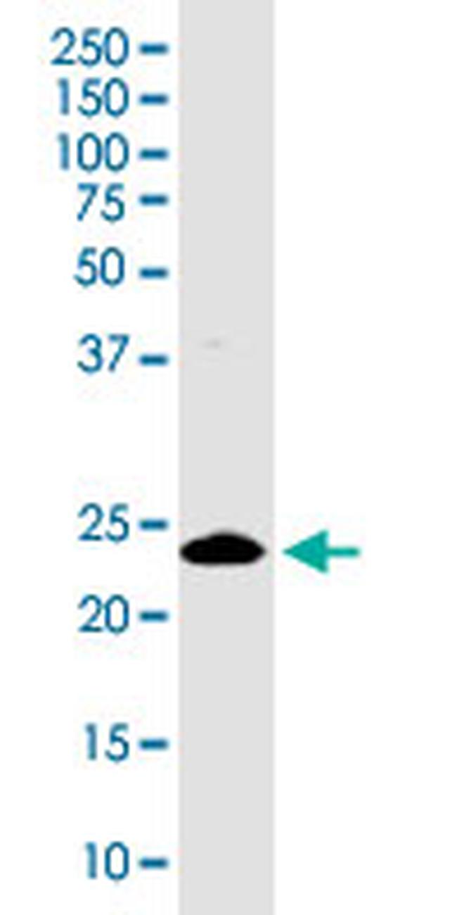 ZBTB8OS Antibody in Western Blot (WB)
