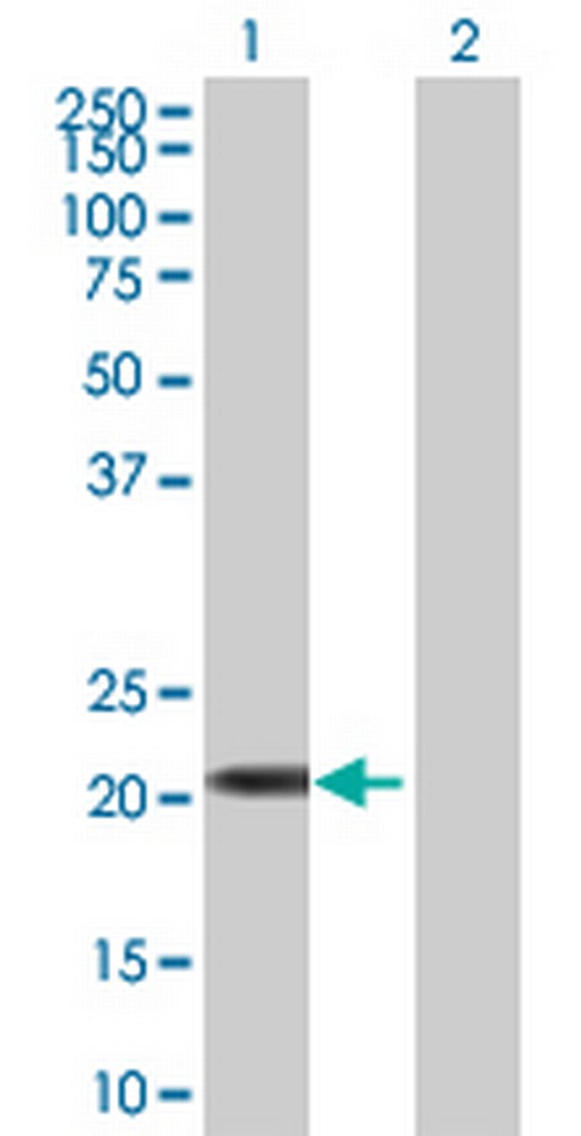 FLJ36180 Antibody in Western Blot (WB)