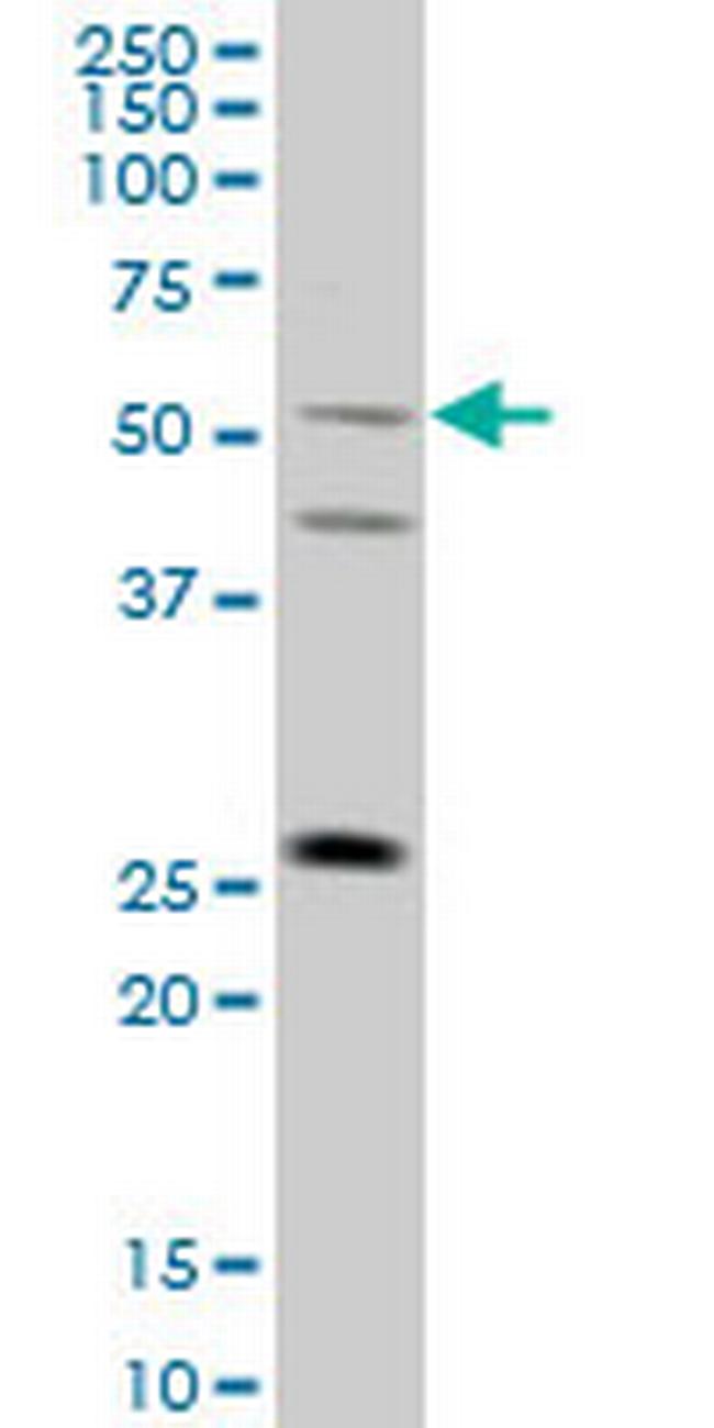FLJ36180 Antibody in Western Blot (WB)