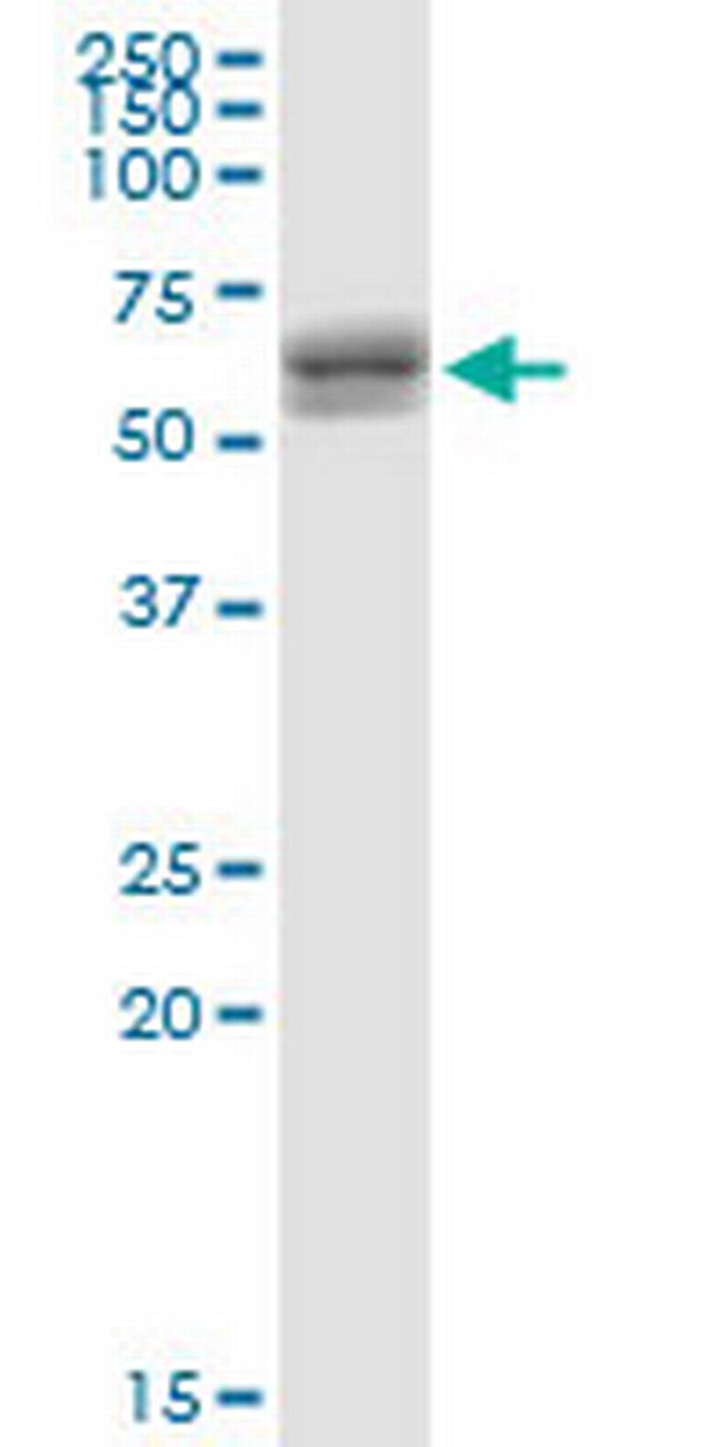 ZNF680 Antibody in Western Blot (WB)