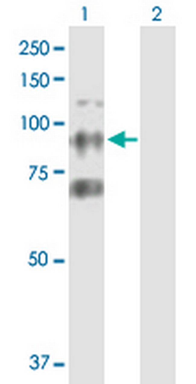 CTAGE6 Antibody in Western Blot (WB)