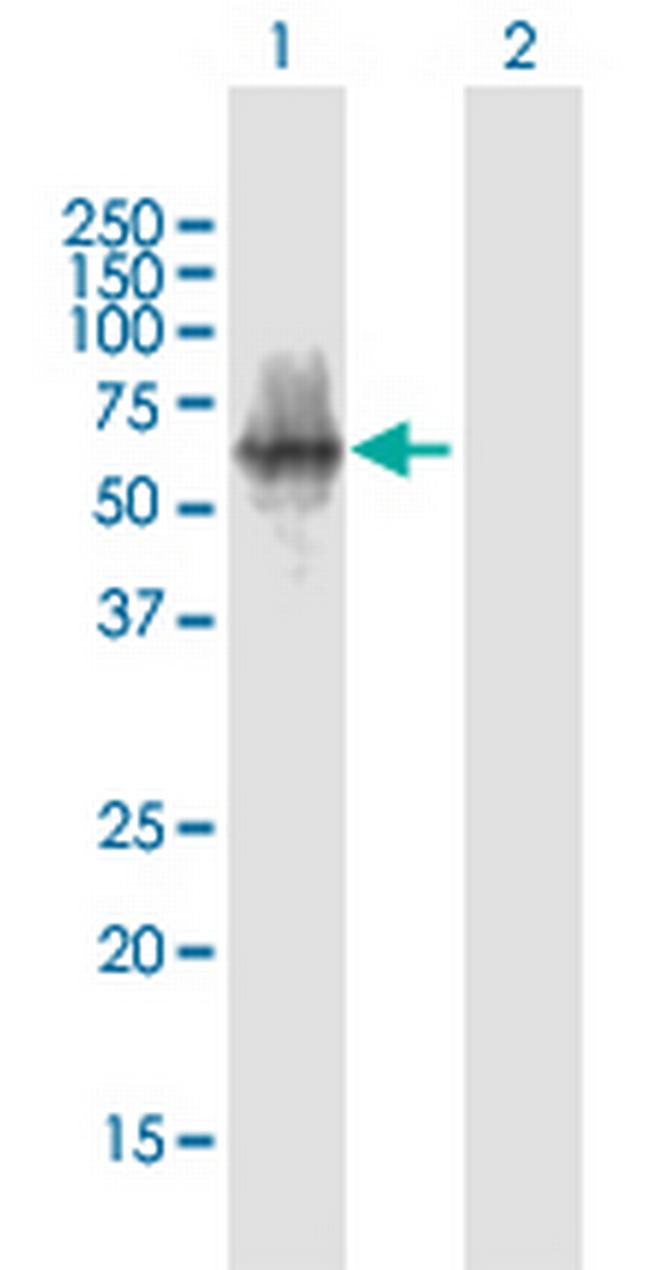 POTEA Antibody in Western Blot (WB)