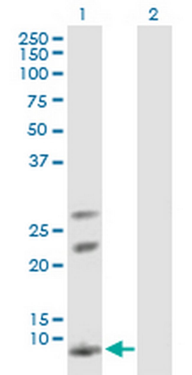 AKR1CL1 Antibody in Western Blot (WB)