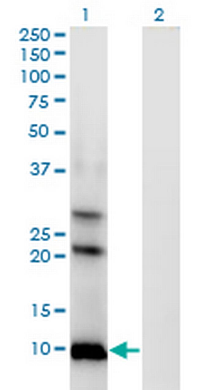 AKR1CL1 Antibody in Western Blot (WB)