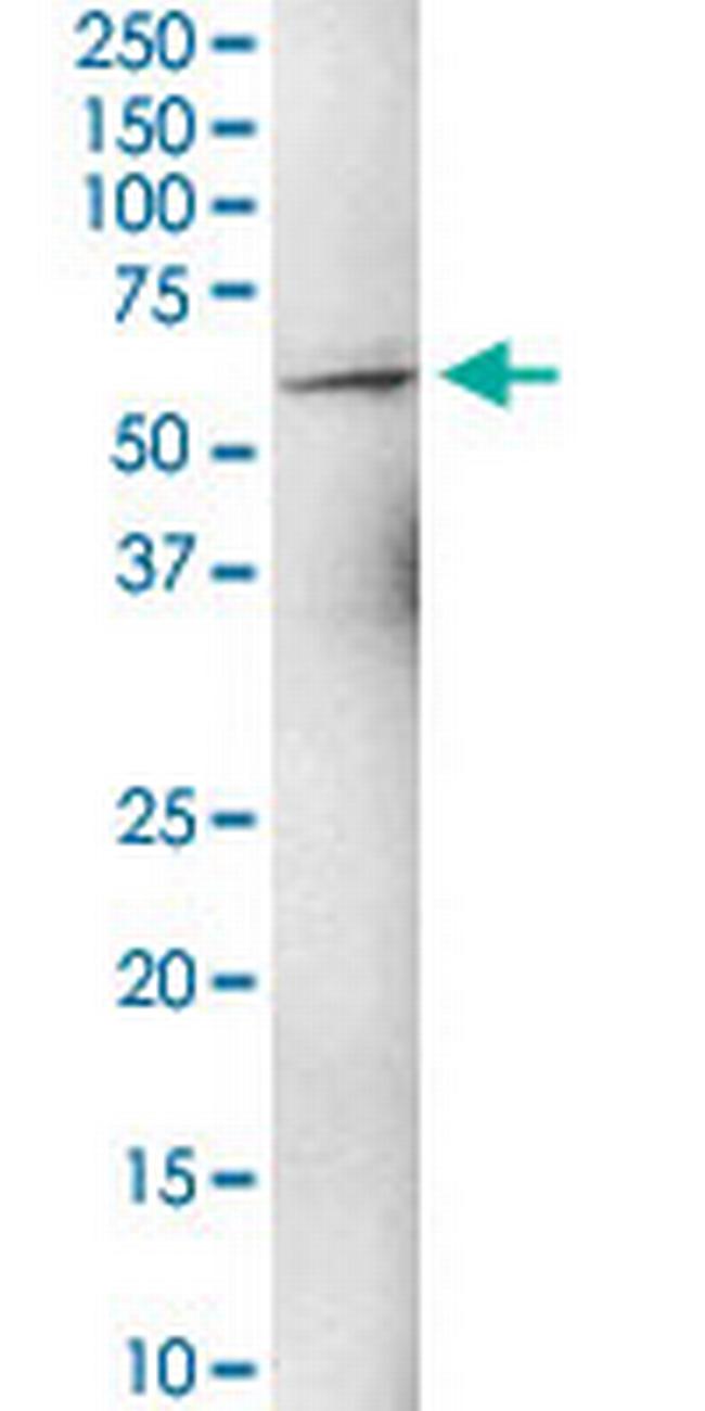 ZNF284 Antibody in Western Blot (WB)