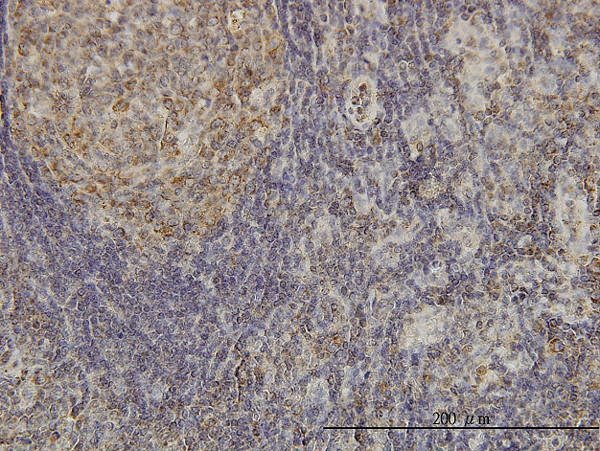 CDKL4 Antibody in Immunohistochemistry (Paraffin) (IHC (P))
