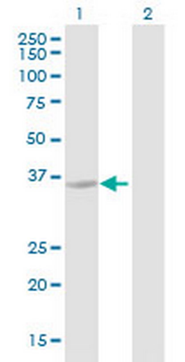 HSD17B13 Antibody in Western Blot (WB)