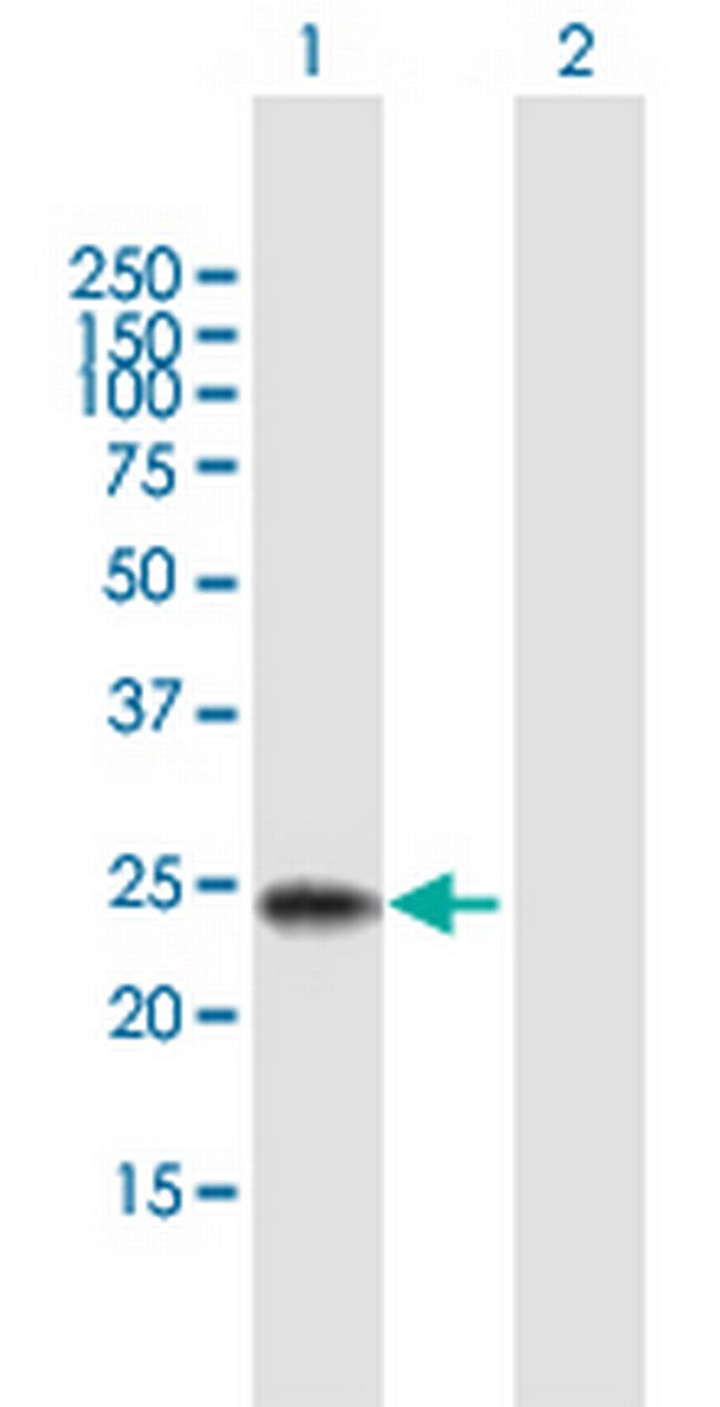 RBPMS2 Antibody in Western Blot (WB)