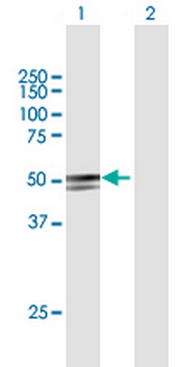 ANKDD1A Antibody in Western Blot (WB)