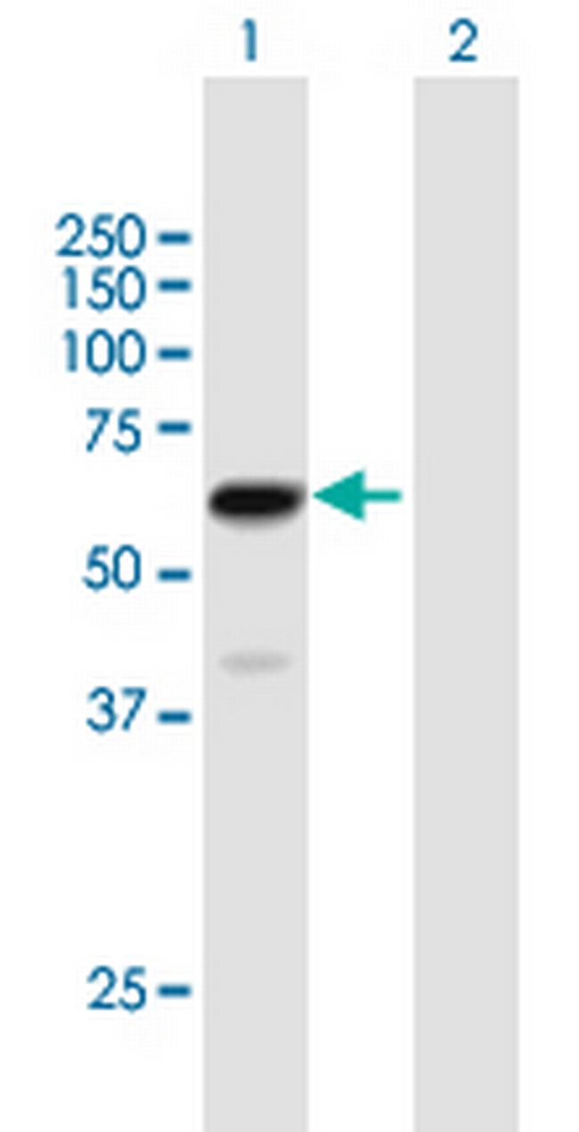 ZNF530 Antibody in Western Blot (WB)