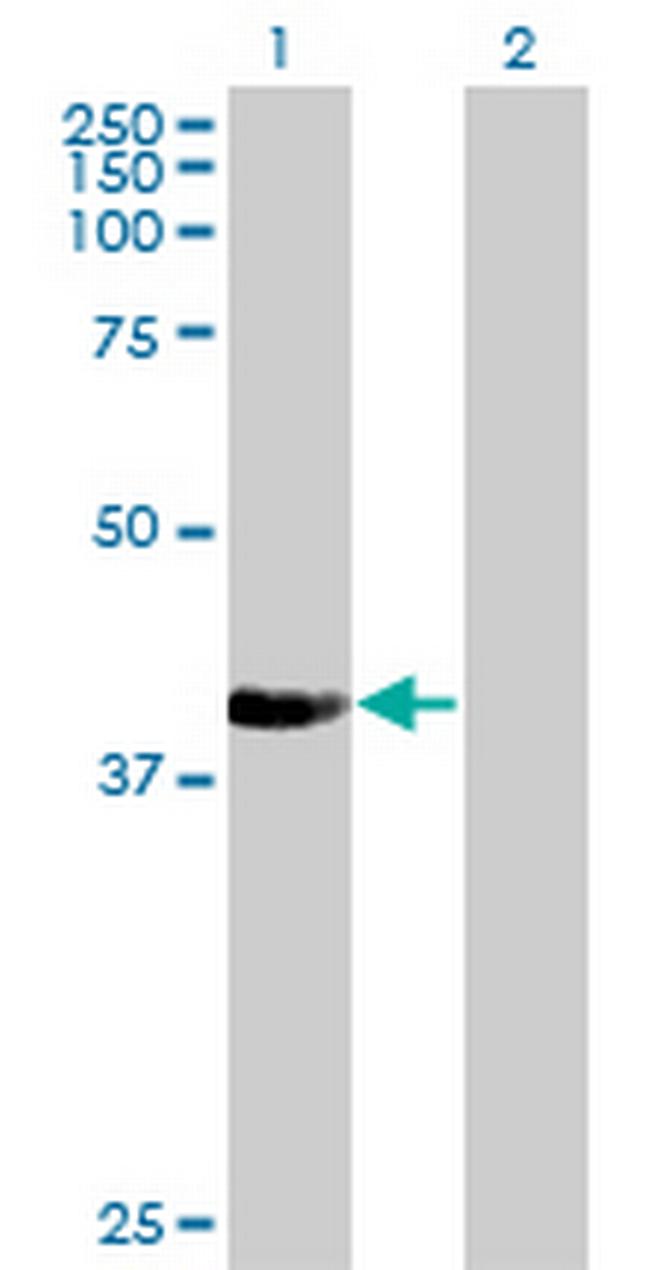 NUP43 Antibody in Western Blot (WB)