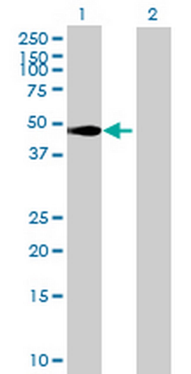 ZNF713 Antibody in Western Blot (WB)