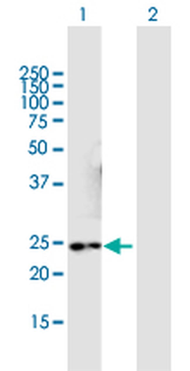 NMNAT3 Antibody in Western Blot (WB)