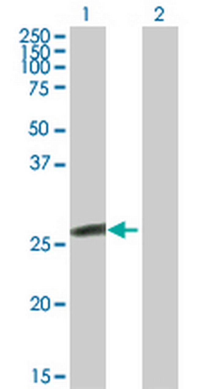 GSTK1 Antibody in Western Blot (WB)