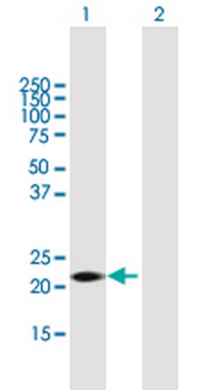 GSTK1 Antibody in Western Blot (WB)