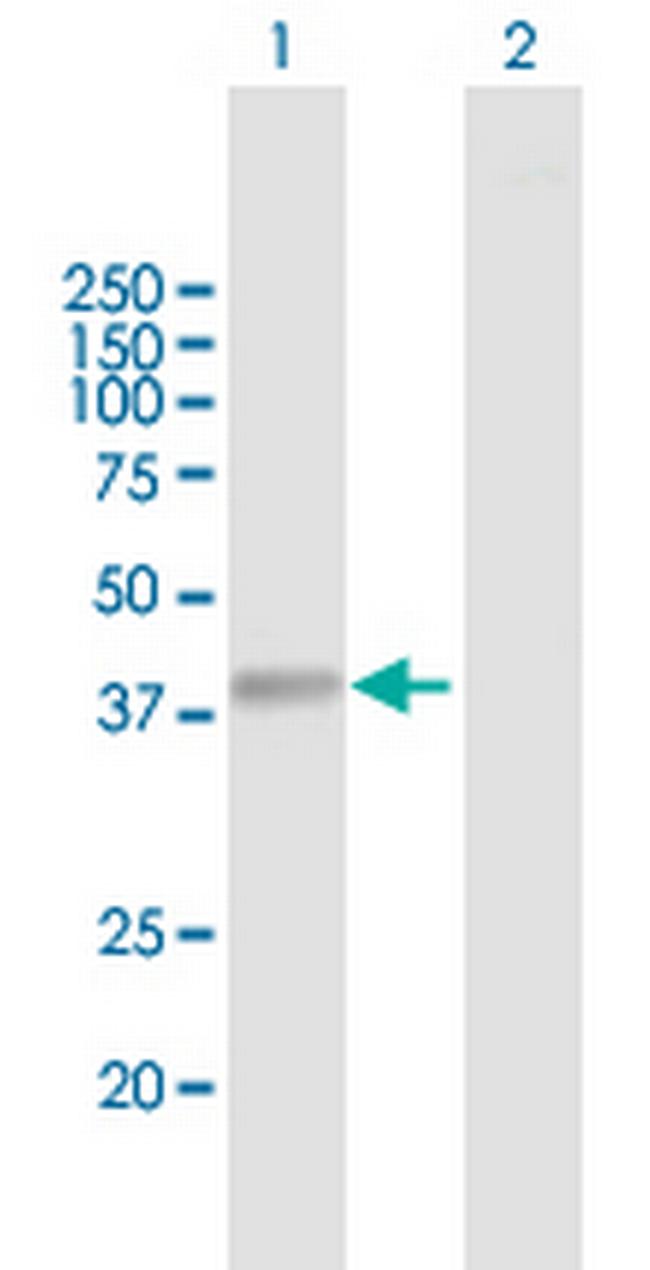 NHLRC2 Antibody in Western Blot (WB)