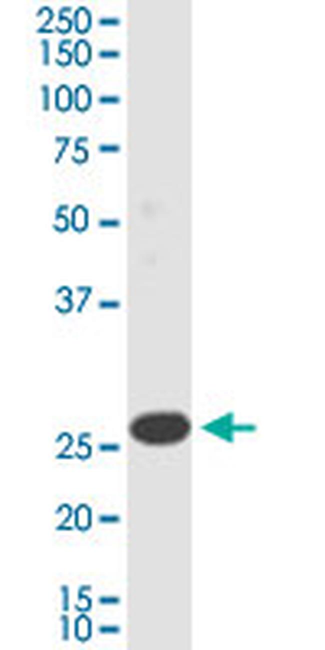 TMEM179B Antibody in Western Blot (WB)