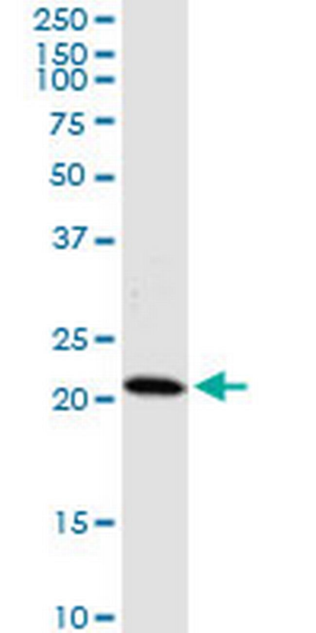 HDDC3 Antibody in Western Blot (WB)
