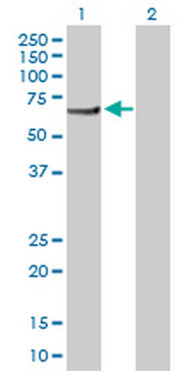 PI4KAP2 Antibody in Western Blot (WB)