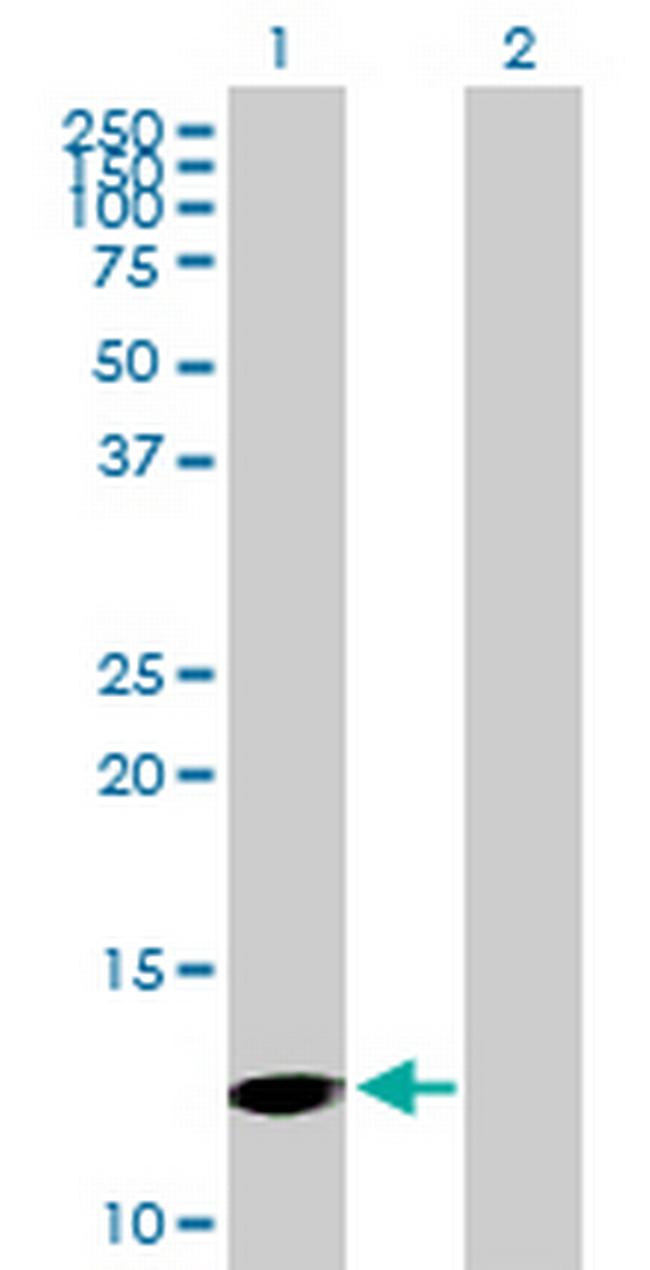 PFN4 Antibody in Western Blot (WB)