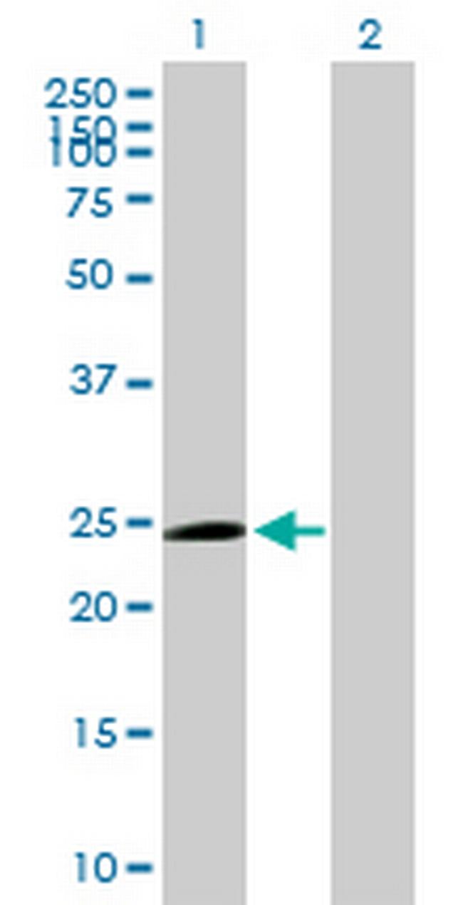 TRIM50C Antibody in Western Blot (WB)