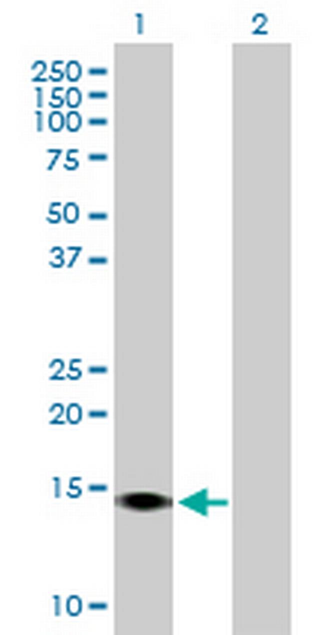 SUMO4 Antibody in Western Blot (WB)