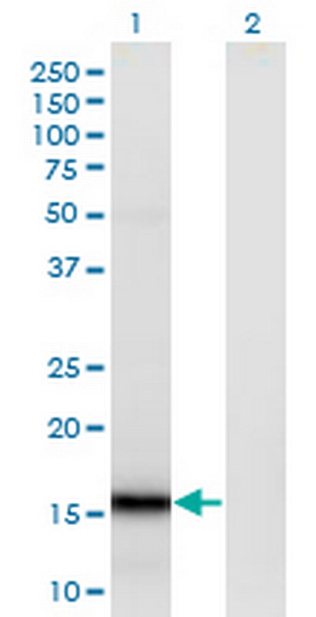 SUMO4 Antibody in Western Blot (WB)