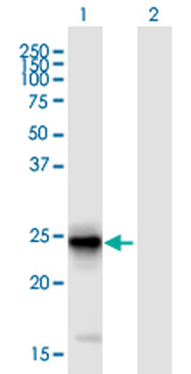 FIBIN Antibody in Western Blot (WB)