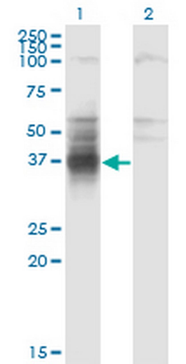 TMIGD1 Antibody in Western Blot (WB)
