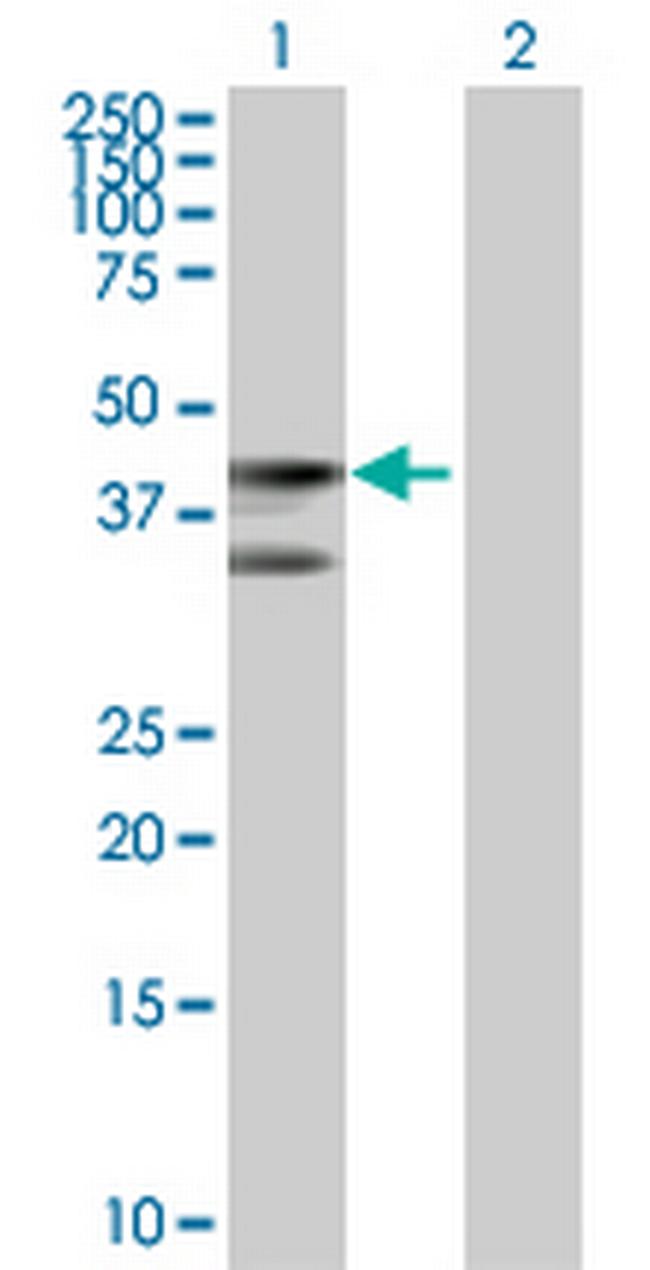LOC388503 Antibody in Western Blot (WB)