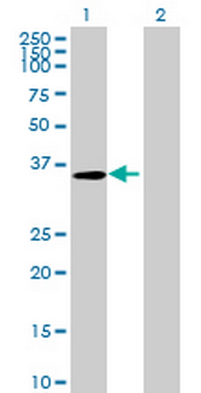 RP11-169K16.3 Antibody in Western Blot (WB)
