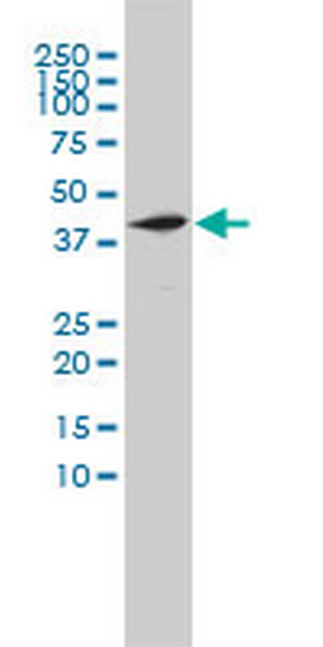 NOTCH2NL Antibody in Western Blot (WB)