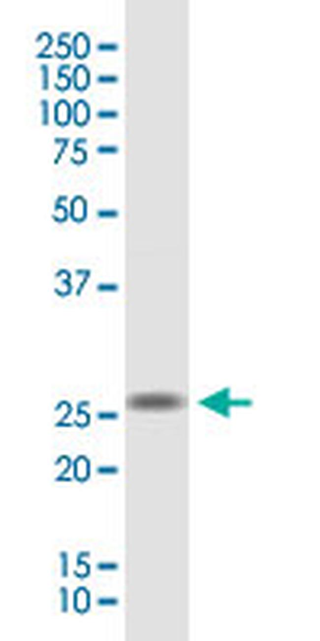TMEM81 Antibody in Western Blot (WB)