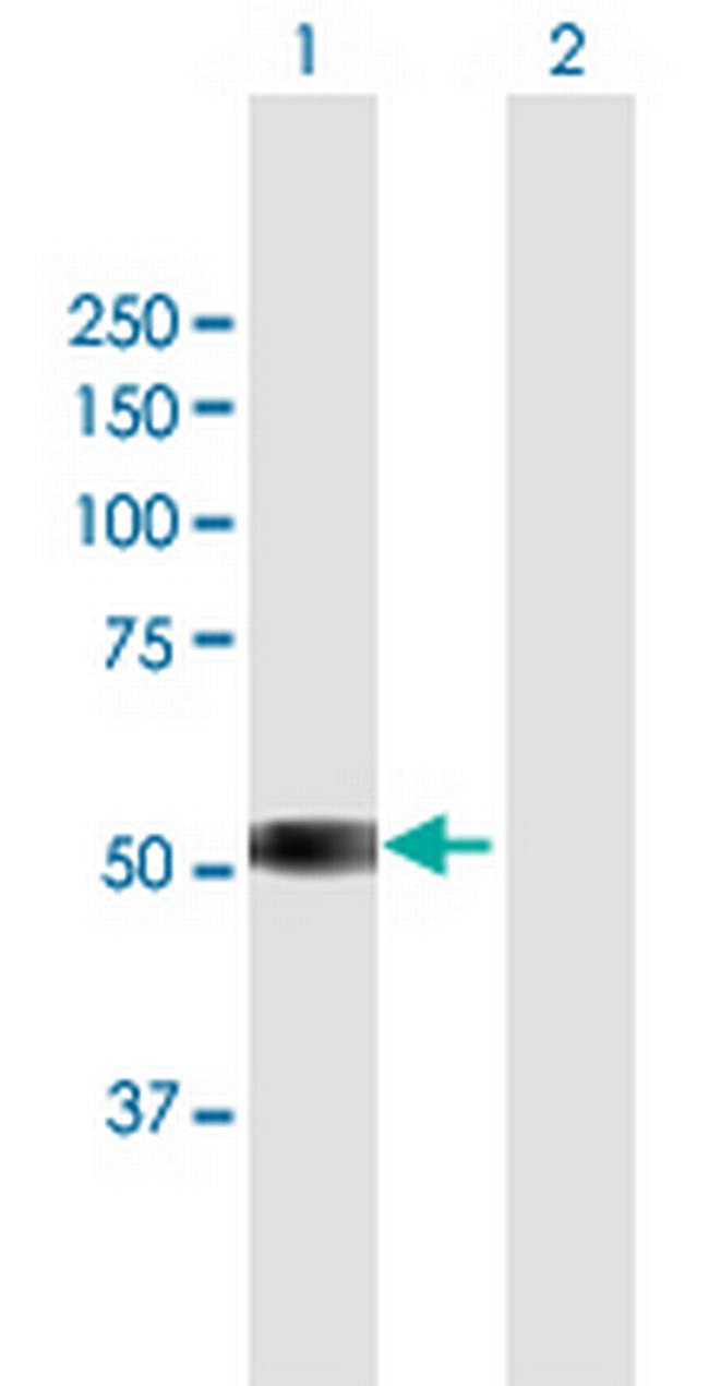 TSPYL6 Antibody in Western Blot (WB)