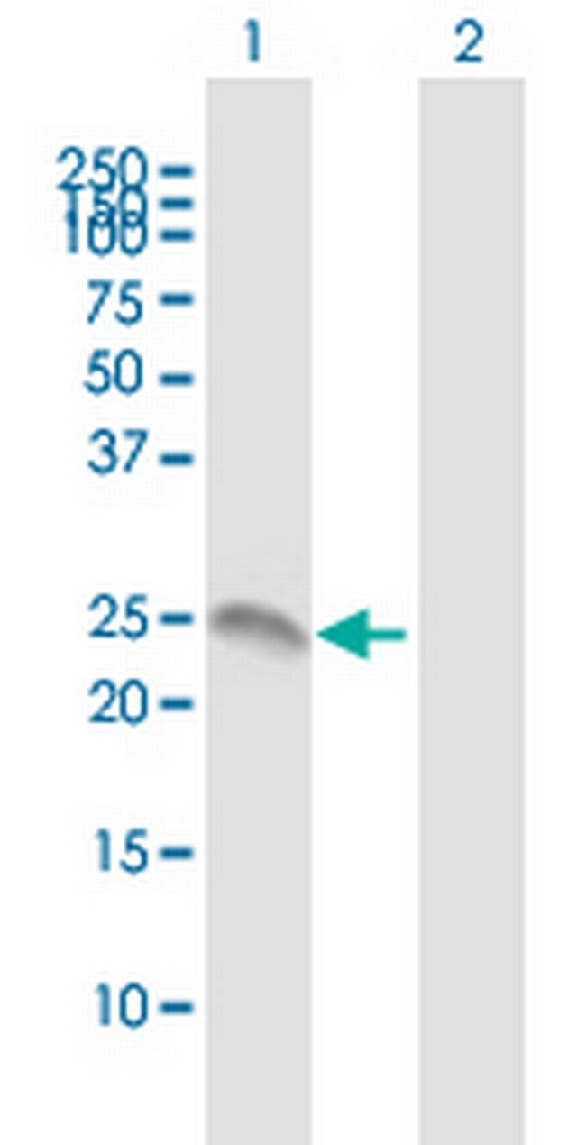 ANXA2R Antibody in Western Blot (WB)
