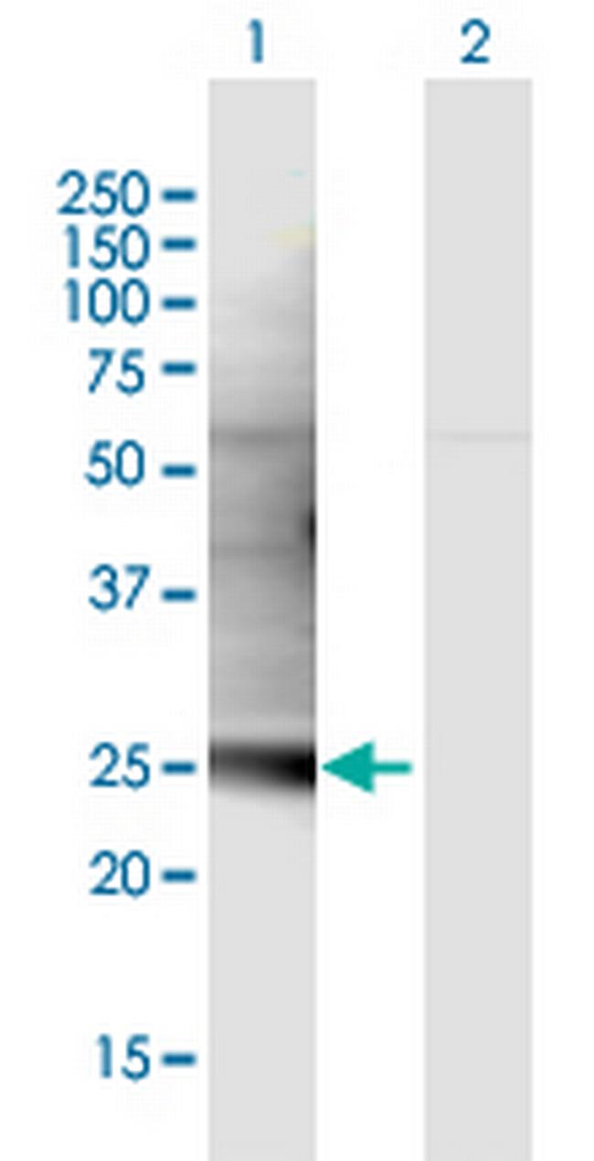 C1QL3 Antibody in Western Blot (WB)