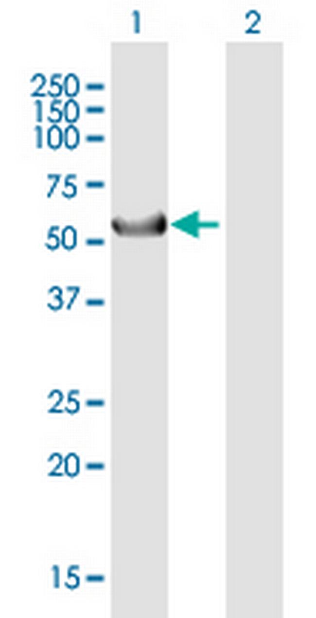 KRT39 Antibody in Western Blot (WB)