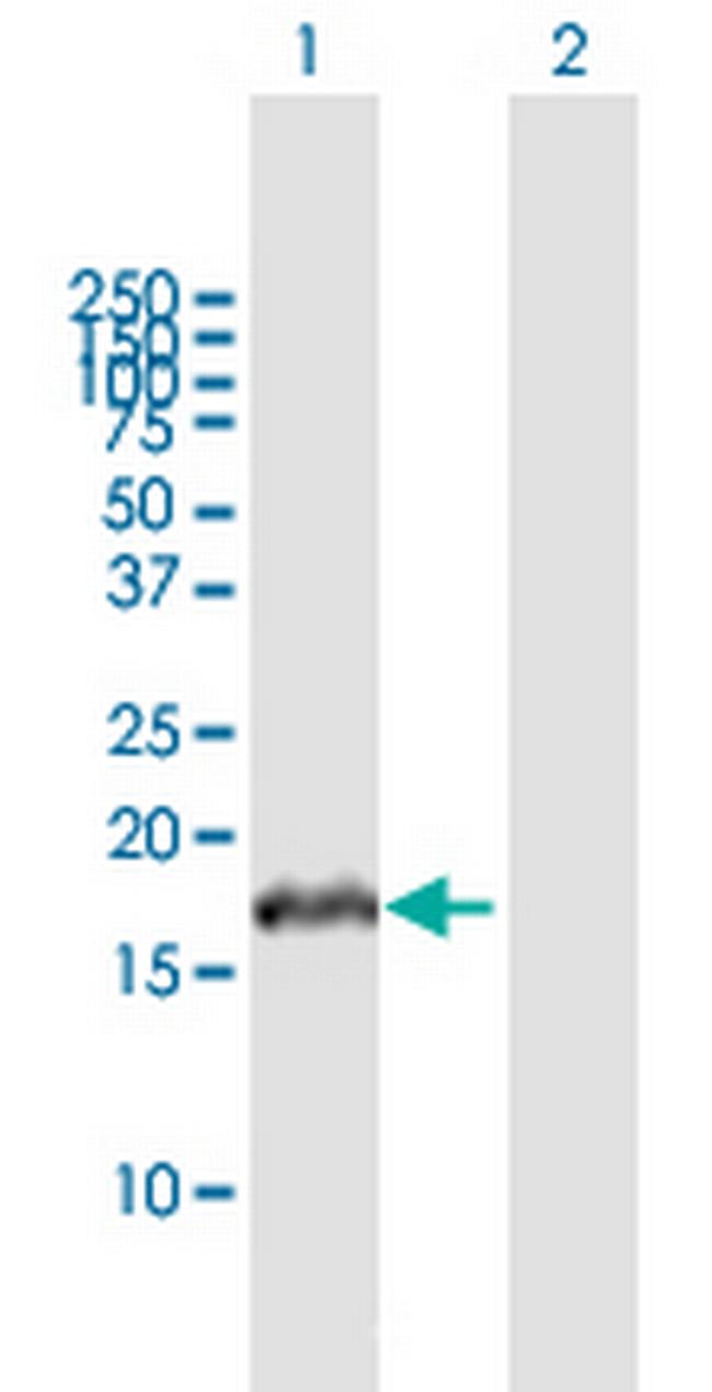 VHLL Antibody in Western Blot (WB)