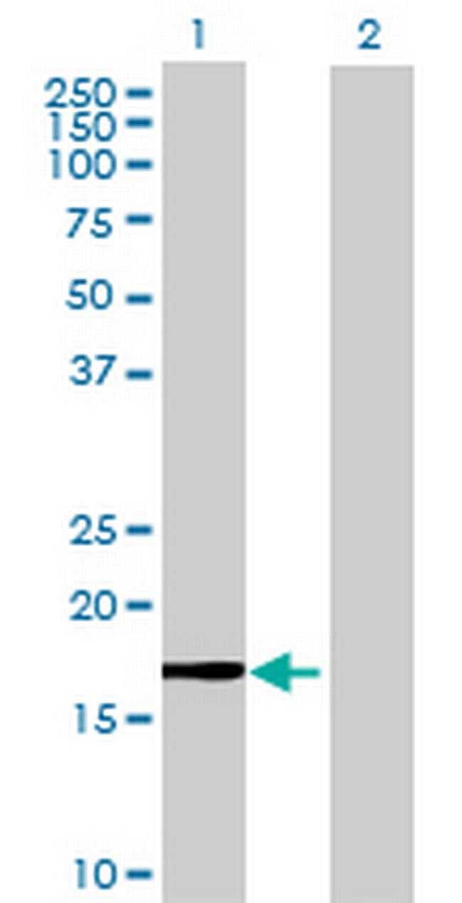 MGC34774 Antibody in Western Blot (WB)