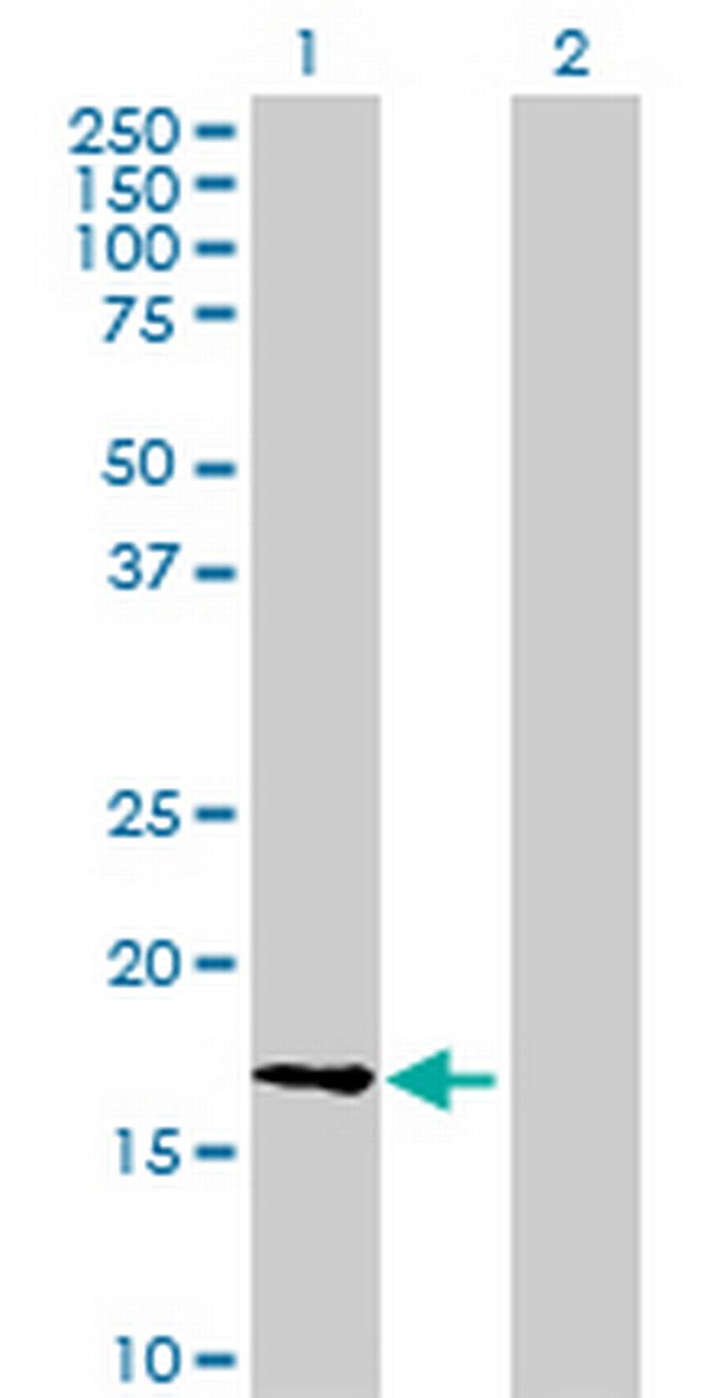 FLJ39779 Antibody in Western Blot (WB)