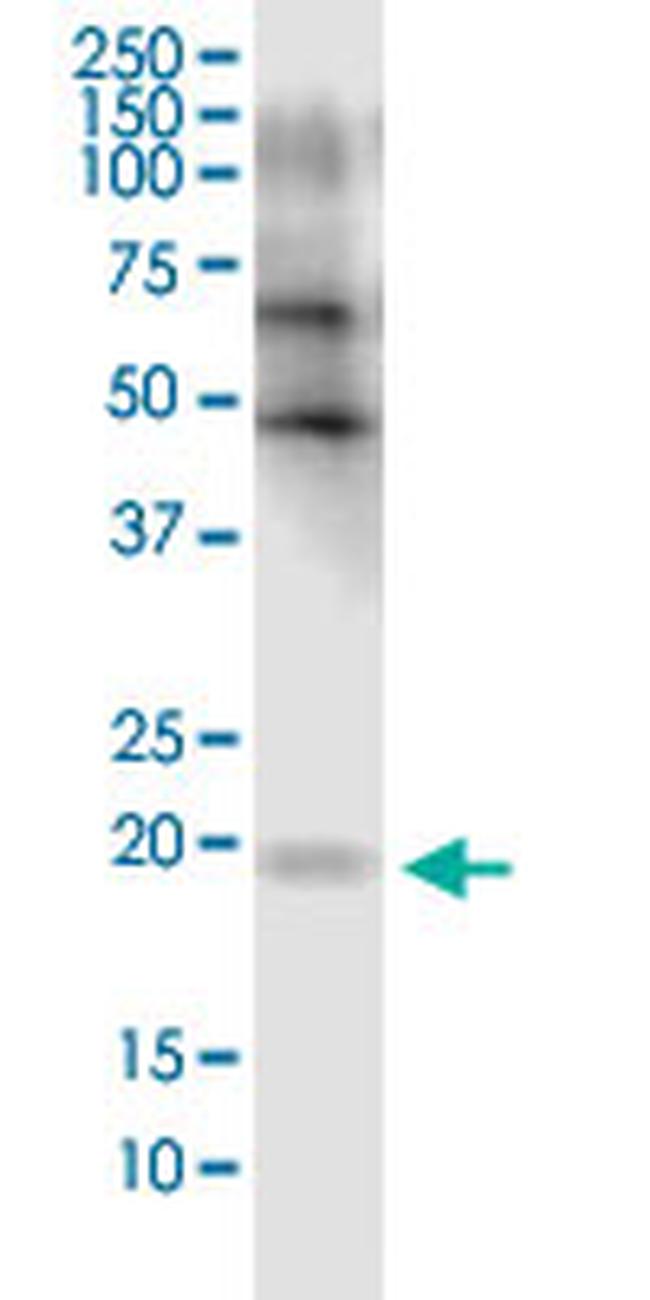FLJ35767 Antibody in Western Blot (WB)